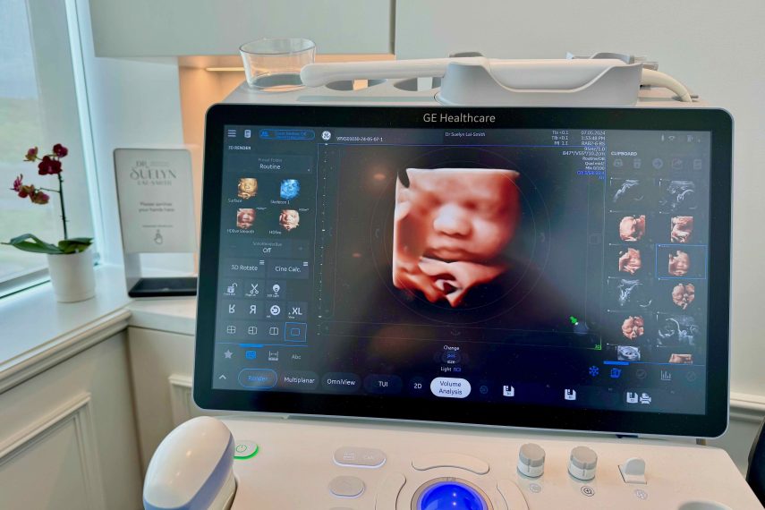 3DUltrasoundBaby(1)1770525599