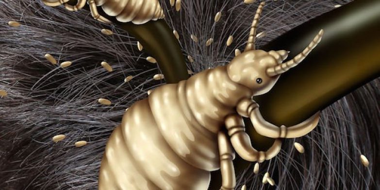 A closer look at head lice and nits! | North Shore Mums